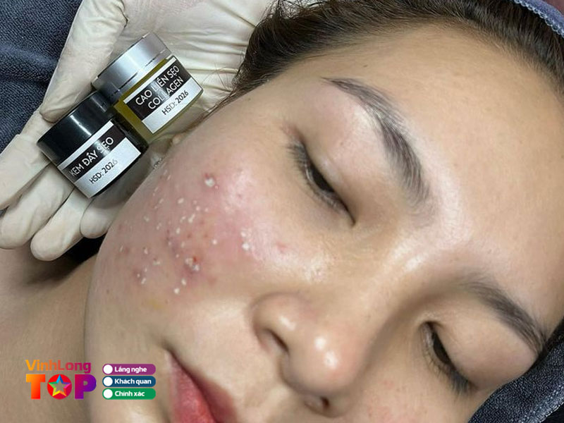 Calee-beauty-vinhlongtoplist