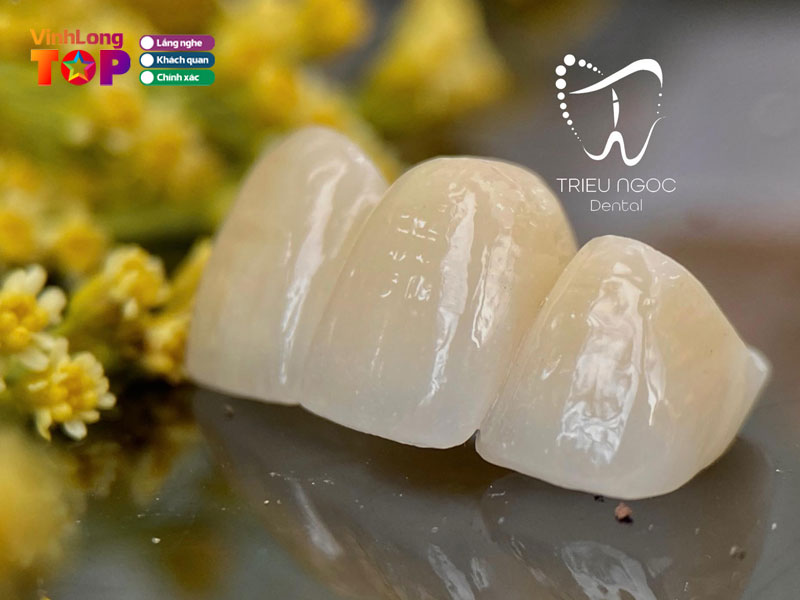 Nha-khoa-trieu-ngoc-vinhlongtoplist