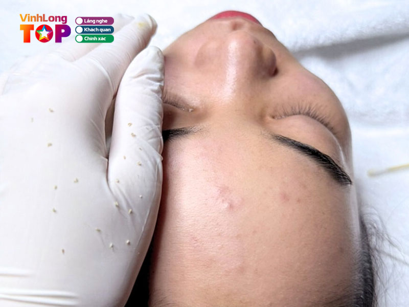 Tham-my-vien-seoul-center-vinhlongtoplist