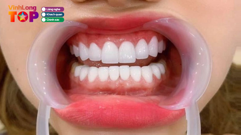 Top-10-nha-khoa-boc-rang-su-tai-vinh-long-dep-an-toan-vinhlongtoplist